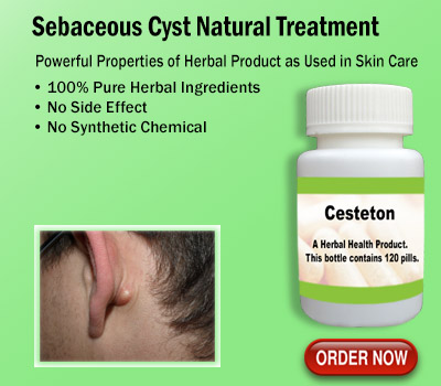 Sebaceous Cyst Natural Treatment